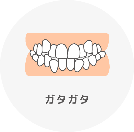 ガタガタ