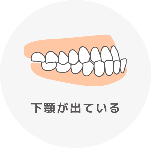 下顎が出ている