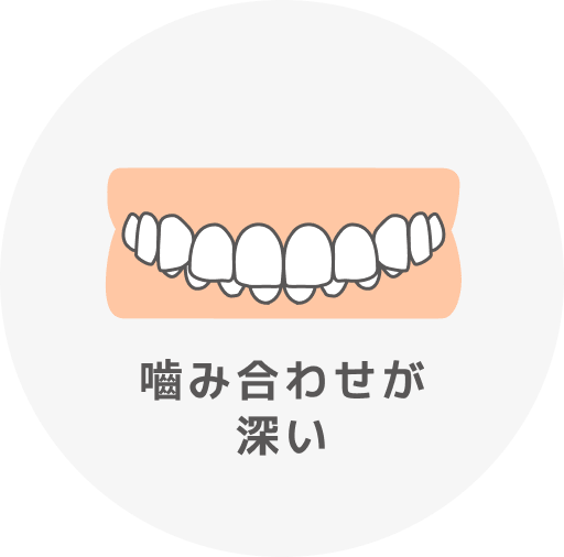 嚙み合わせのズレ