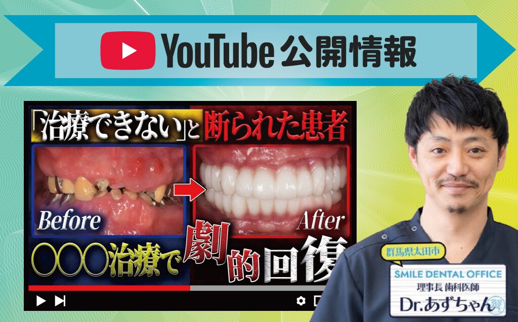 他院で治療を断られた患者の劇的ビフォーアフターを解説！【インプラント】